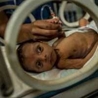 fome-mata-numero-recorde-de-criancas-na-venezuel-2.jpg