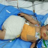 Laylah Ziyarah | Hani é o bebê mais novo da Faixa de Gaza a perder uma perna nesta guerra.